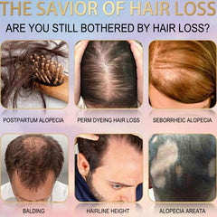 OUHOE Biotin Hair Serum