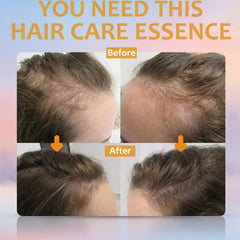 OUHOE Biotin Hair Serum